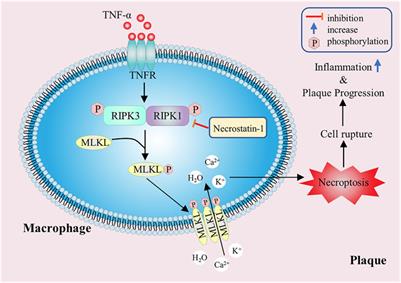 The Function, Regulation and Mechanism of Programmed Cell Death of Macrophages in Atherosclerosis